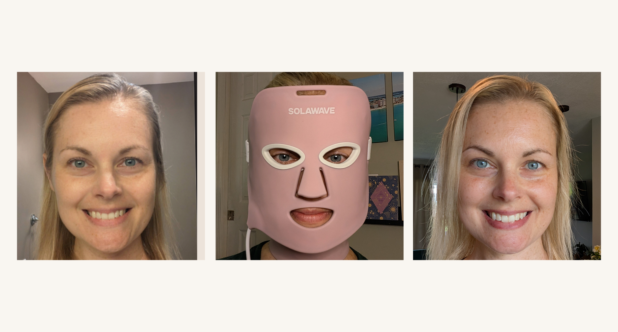 Máscara de retirada de arrugas de Solawave, revisada (con fotos)